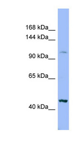 XYLT2 antibody LS-C107653 Western blot of HT1080 cell lysate.