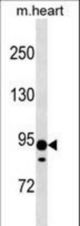 XYLT2 Antibody western blot of mouse heart tissue lysates (35 ug/lane). The XYLT2 antibody detected the XYLT2 protein (arrow).