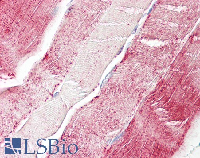 Human, Skeletal muscle: Formalin-Fixed Paraffin-Embedded (FFPE)