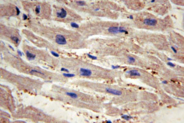 IHC of YAP (H122) pAb in paraffin-embedded human heart tissue.