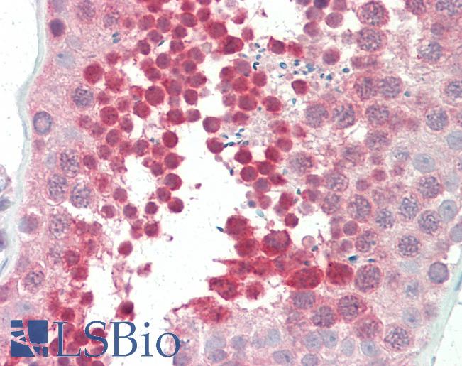 Anti-YBX3 / CSDA antibody IHC staining of human testis. Immunohistochemistry of formalin-fixed, paraffin-embedded tissue after heat-induced antigen retrieval. Antibody LS-B10359 concentration 5 ug/ml.