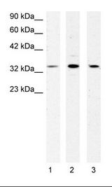 1. Jurkat Cell Lysate, 2. HepG2 Cell Lysate, 3. Fetal Muscle Lysate