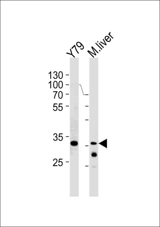 CSDA Antibody western blot of Y79 cell line and mouse liver lysates (35 ug/lane). The CSDA antibody detected the CSDA protein (arrow).