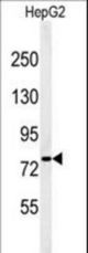 Western blot of YMEL1 Antibody in HepG2 cell line lysates (35 ug/lane). YMEL1 (arrow) was detected using the purified antibody.