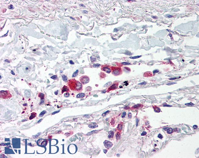 Anti-TLR5 antibody IHC of human lung, alveolar macrophages. Immunohistochemistry of formalin-fixed, paraffin-embedded tissue after heat-induced antigen retrieval. Antibody LS-B601 concentration 5 ug/ml.