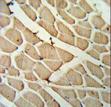 YTHD3 Antibody IHC of formalin-fixed and paraffin-embedded skeletal muscle followed by peroxidase-conjugated secondary antibody and DAB staining.