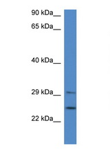 YWHAB / 14-3-3 Beta antibody LS-C134912 Western blot of Fetal Brain lysate. Antibody concentration 1 ug/ml.