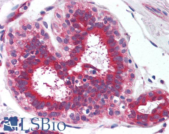 Anti-YWHAE / 14-3-3 Epsilon antibody IHC of human breast. Immunohistochemistry of formalin-fixed, paraffin-embedded tissue after heat-induced antigen retrieval. Antibody LS-B3683 dilution 1:400.