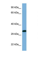 YWHAE / 14-3-3 Epsilon antibody LS-C145751 Western blot of Placenta lysate. Antibody concentration 1 ug/ml.