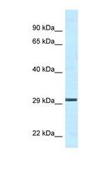 YWHAE / 14-3-3 Epsilon antibody LS-C145478 Western blot of Mouse Kidney lysate. Antibody concentration 1 ug/ml.