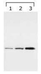 14-3-3 gamma detected in lysates. Lane 1: HeLa cell lysate, Lanes 2 & 3: bengamide treated lysates (8h and 24h, respectively).