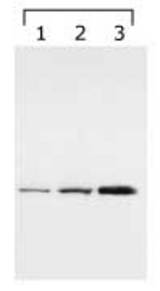 14-3-3 gamma detected in lysates. Lane 1: HeLa cell lysate, Lanes 2 & 3: bengamide treated lysates (8h and 24h, respectively).