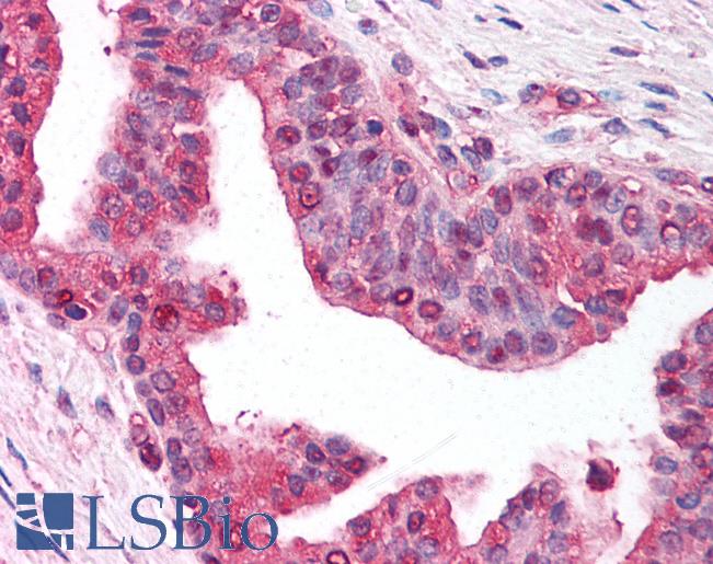 Anti-YWHAG / 14-3-3 Gamma antibody IHC of human prostate. Immunohistochemistry of formalin-fixed, paraffin-embedded tissue after heat-induced antigen retrieval. Antibody LS-B213 dilution 1:500.