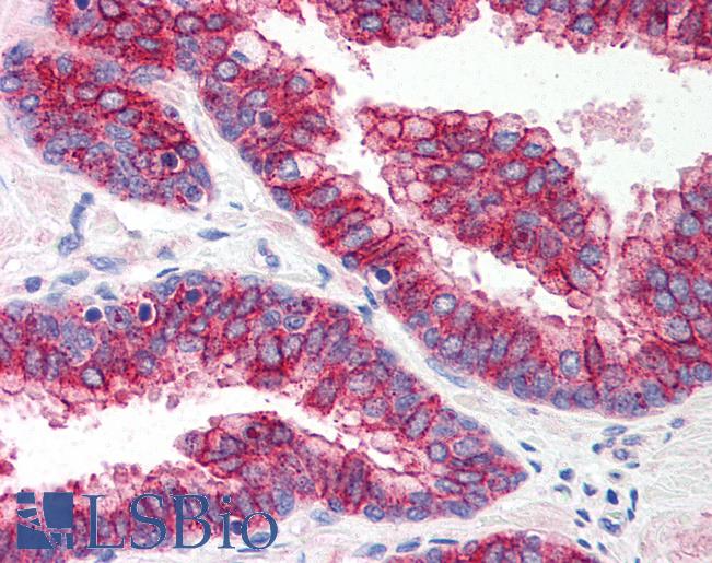 Anti-TLR5 antibody IHC of human prostate. Immunohistochemistry of formalin-fixed, paraffin-embedded tissue after heat-induced antigen retrieval. Antibody LS-B601 concentration 5 ug/ml.