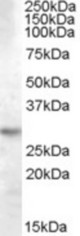 Antibody (0.03 ug/ml) staining of Human Brain (Hippocampus) lysate (35 ug protein in RIPA buffer). Primary incubation was 1 hour. Detected by chemiluminescence.