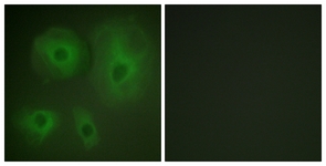 Immunofluorescence of HeLa cells, using 14-3-3 theta/tau (Ab-232) Antibody. The picture on the right is treated with the synthesized peptide.