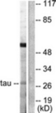 Western blot of extracts from HeLa cells, using 14-3-3 theta/tau (Ab-232) Antibody. The lane on the right is treated with the synthesized peptide.