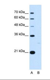 Lane A: Marker. Lane B: HepG2 cell lysate. Antibody concentration: 5.0 ug/ml. Gel concentration: 12%.