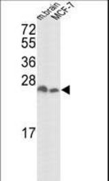 Western blot of hYWHAZ-D231 in mouse brain tissue and MCF-7 cell line lysates (35 ug/lane). YWHAZ (arrow) was detected using the purified antibody.