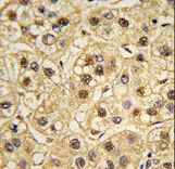 Formalin-fixed and paraffin-embedded human testis tissue reacted with YWHAZ Antibody , which was peroxidase-conjugated to the secondary antibody, followed by DAB staining. This data demonstrates the use of this antibody for immunohistochemistry; clinical relevance has not been evaluated.