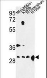 Western blot of YWHAZ Antibody in MDA-MB231, A2058 cell line and mouse cerebellum, brain tissue lysates (35 ug/lane). YWHAZ (arrow) was detected using the purified antibody.