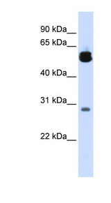 YWHAZ / 14-3-3 Zeta Delta antibody LS-B5807 Western blot of Fetal Lung lysate.