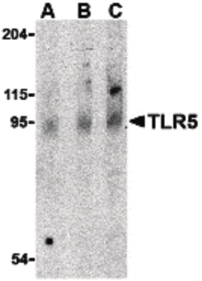 Western blot of TLR5 in rat brain cell lysate with TLR5 antibody at (A) 0.5, (B) 1 and (C) 2 ug/ml.