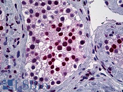 Anti-YY1 antibody IHC of human, testis. Immunohistochemistry of formalin-fixed, paraffin-embedded tissue after heat-induced antigen retrieval. Antibody LS-B5551 concentration 5 ug/ml.
