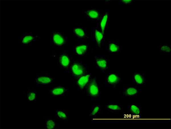 Immunofluorescence of monoclonal antibody to YY1 on HeLa cell. [antibody concentration 10 ug/ml]