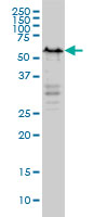 YY1 monoclonal antibody clone 4D2 Western blot of YY1 expression in HeLa NE.