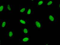 Immunostaining analysis in HeLa cells. HeLa cells were fixed with 4% paraformaldehyde and permeabilized with 0.1% Triton X-100 in PBS. The cells were immunostained with anti-YY1 mAb.