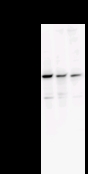 Detection of YY1 by Western blot. Samples: Whole cell lysate from human HEK293 (H, 25 ug) , mouse NIH3T3 (M, 25 ug) and rat F2408 (R, 25 ug) cells. Predicted molecular weight: 45 kDa