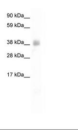 Fetal Thymus Lysate