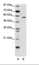 A: Marker, B: Jurkat Cell Lysate