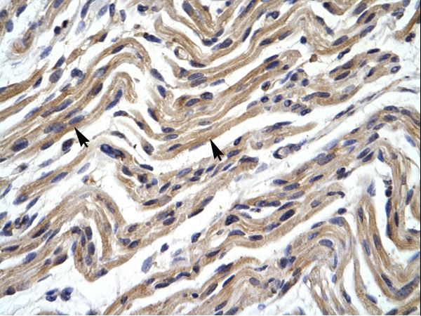YY1 antibody LS-C29977 was used in IHC to stain formalin-fixed, paraffin-embedded human muscle.