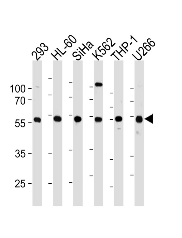 YY1 Antibody (L89) western blot of 293,HL-60,SiHa,K562,THP-1,U266 cell line lysates (35 ug/lane). The YY1 antibody detected the YY1 protein (arrow).