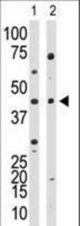 Western blot of anti-YY1 Ctr antibody in HL60 cell lysate (lane 1) and in mouse kidney tissue lysate (lane 2). YY1 (arrow) was detected using purified antibody. Secondary HRP-anti-rabbit was used for signal visualization with chemiluminescence.