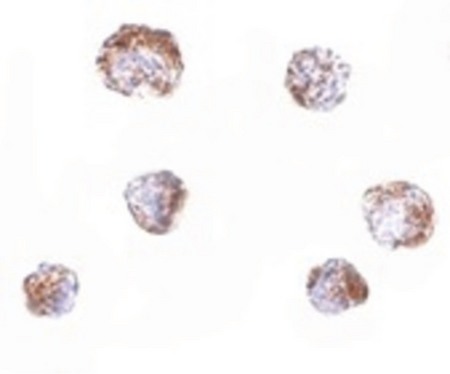 Immunocytochemistry of ZBED3 in A549 cells with ZBED3 antibody at 20 ug/ml.