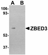 Western blot of ZBED3 in human lung tissue lysate with ZBED3 antibody at 1 ug/ml in (A) the absence and (B) the presence of blocking peptide. Below: Immunocytochemistry of ZBED3 in A549 cells with ZBED3 antibody at 20 ug/ml.