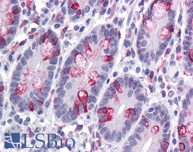 Anti-ZBED3 antibody IHC of human small intestine. Immunohistochemistry of formalin-fixed, paraffin-embedded tissue after heat-induced antigen retrieval. Antibody LS-B4602 concentration 5 ug/ml.