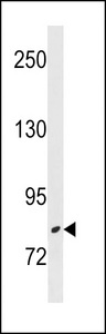 ZBTB17 Antibody western blot of NCI-H460 cell line lysates (35 ug/lane). The ZBTB17 antibody detected the ZBTB17 protein (arrow).