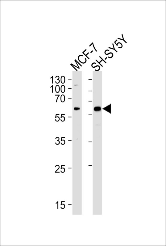 Western blot of lysates from MCF-7, SH-SY5Y cell line (from left to right), using ZBTB22 Antibody. Antibody was diluted at 1:1000 at each lane. A goat anti-rabbit IgG H&L (HRP) at 1:5000 dilution was used as the secondary antibody. Lysates at 35ug per lane.