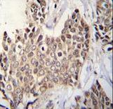 ZBTB42 Antibody immunohistochemistry of formalin-fixed and paraffin-embedded human breast tissue followed by peroxidase-conjugated secondary antibody and DAB staining.