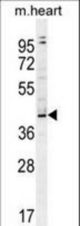 ZBTB42 Antibody western blot of mouse heart tissue lysates (35 ug/lane). The ZBTB42 antibody detected the ZBTB42 protein (arrow).
