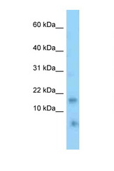TNFRSF12A / TWEAKR antibody LS-C146338 Western blot of Mouse Kidney lysate. Antibody concentration 1 ug/ml.