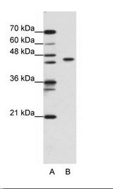 A: Marker, B: Jurkat Cell Lysate