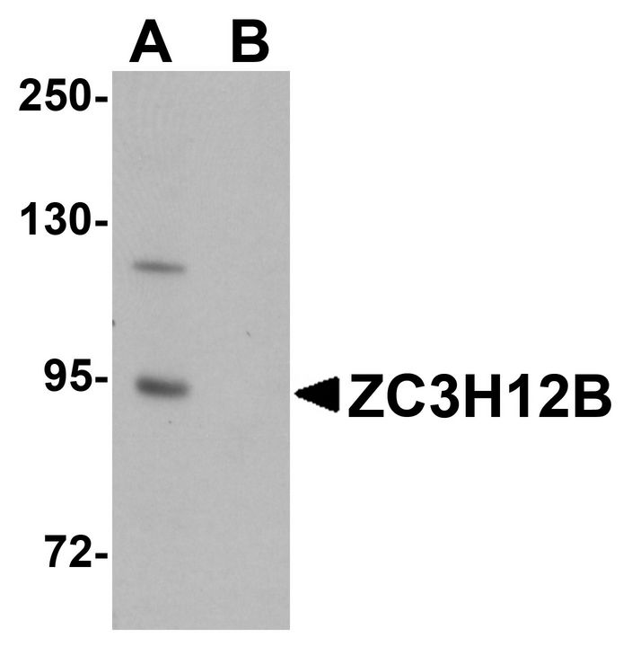 Western blot analysis of ZC3H12B in mouse brain tissue lysate with ZC3H12B antibody at 1 ug/ml in (A) the absence and (B) the presence of blocking peptide.