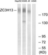 Western blot of extracts from A549/Jurkat/HepG2 cells, using ZC3H13 Antibody. The lane on the right is treated with the synthesized peptide.