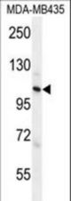 ZC3H3 Antibody western blot of MDA-MB435 cell line lysates (35 ug/lane). The ZC3H3 antibody detected the ZC3H3 protein (arrow).