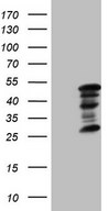 HEK293T cells were transfected with the pCMV6-ENTRY control (Left lane) or pCMV6-ENTRY ZC3H8 (Right lane) cDNA for 48 hrs and lysed. Equivalent amounts of cell lysates (5 ug per lane) were separated by SDS-PAGE and immunoblotted with anti-ZC3H8 (1:2000).